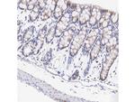 MTCO1 Antibody in Immunohistochemistry (Paraffin) (IHC (P))