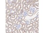 MTCO1 Antibody in Immunohistochemistry (Paraffin) (IHC (P))