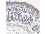 MTCO1 Antibody in Immunohistochemistry (Paraffin) (IHC (P))