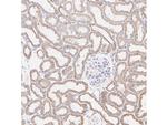 MTCO1 Antibody in Immunohistochemistry (Paraffin) (IHC (P))
