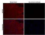 MTCO1 Antibody in Immunohistochemistry (Paraffin) (IHC (P))