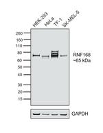 RNF168 Antibody in Western Blot (WB)