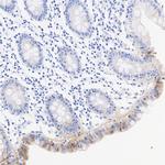 Laminin gamma-2 Antibody in Immunohistochemistry (Paraffin) (IHC (P))
