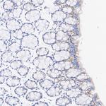 Laminin gamma-2 Antibody in Immunohistochemistry (Paraffin) (IHC (P))