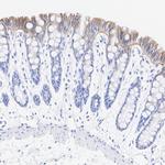 Laminin gamma-2 Antibody in Immunohistochemistry (Paraffin) (IHC (P))