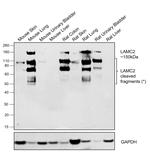 Laminin gamma-2 Antibody