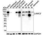 Laminin gamma-2 Antibody in Western Blot (WB)