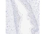 RAR gamma-1 Antibody in Immunohistochemistry (Paraffin) (IHC (P))
