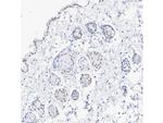 RAR gamma-1 Recombinant Rabbit Monoclonal Antibody (PSH07-19)