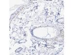 RAR gamma-1 Antibody in Immunohistochemistry (Paraffin) (IHC (P))