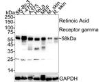 RAR gamma-1 Antibody in Western Blot (WB)