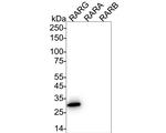 RAR gamma-1 Antibody in Western Blot (WB)