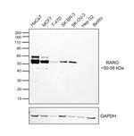 RAR gamma-1 Antibody in Western Blot (WB)