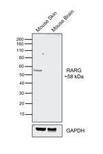 RAR gamma-1 Antibody in Western Blot (WB)