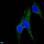 CD146 Recombinant Rabbit Monoclonal Antibody (8A10)