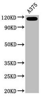 CD146 Antibody in Western Blot (WB)