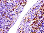 CD31 Antibody in Immunohistochemistry (Paraffin) (IHC (P))