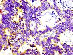 CD74 Antibody in Immunohistochemistry (Paraffin) (IHC (P))