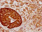 CD63 Antibody in Immunohistochemistry (Paraffin) (IHC (P))