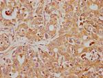 CD63 Antibody in Immunohistochemistry (Paraffin) (IHC (P))