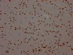 BRD4 Antibody in Immunohistochemistry (Paraffin) (IHC (P))