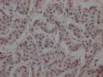 BRD4 Recombinant Rabbit Monoclonal Antibody (1E5)