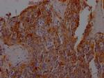 ICAM-1 Antibody in Immunohistochemistry (Paraffin) (IHC (P))