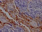 ICAM-1 Antibody in Immunohistochemistry (Paraffin) (IHC (P))