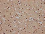 SOX10 Antibody in Immunohistochemistry (Paraffin) (IHC (P))