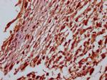 SOX10 Antibody in Immunohistochemistry (Paraffin) (IHC (P))
