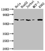 HDAC2 Antibody in Western Blot (WB)