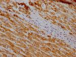 SOD2 Recombinant Rabbit Monoclonal Antibody (10F6)