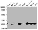 SOD2 Antibody in Western Blot (WB)