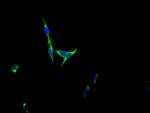 FGFR3 Recombinant Rabbit Monoclonal Antibody (5B6)