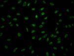 Granzyme B Recombinant Rabbit Monoclonal Antibody (6A1)