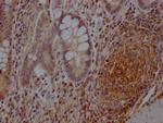 CD73 Antibody in Immunohistochemistry (Paraffin) (IHC (P))