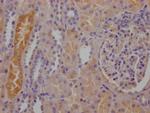 RBP4 Recombinant Rabbit Monoclonal Antibody (9G7)