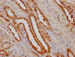 GSTP1 Recombinant Rabbit Monoclonal Antibody (8F6)
