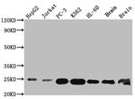 GSTP1 Antibody in Western Blot (WB)