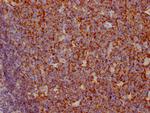 CD35 Antibody in Immunohistochemistry (Paraffin) (IHC (P))
