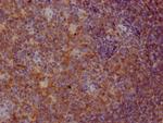 CD22 Antibody in Immunohistochemistry (Paraffin) (IHC (P))