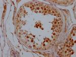 SIRT1 Antibody in Immunohistochemistry (Paraffin) (IHC (P))