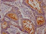 CEACAM1 Antibody in Immunohistochemistry (Paraffin) (IHC (P))