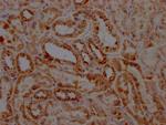 STAT6 Recombinant Rabbit Monoclonal Antibody (2F10)