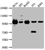 STAT6 Antibody in Western Blot (WB)