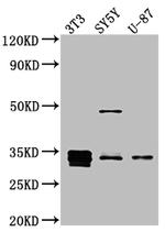 Cyclin D1 Recombinant Rabbit Monoclonal Antibody (5D8)