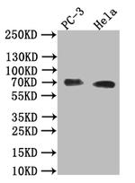 Placental Alkaline Phosphatase Antibody in Western Blot (WB)