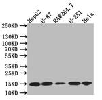 LC3B Recombinant Rabbit Monoclonal Antibody (7D11)