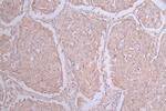 CD155 Antibody in Immunohistochemistry (Paraffin) (IHC (P))