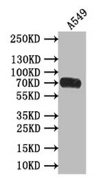 CD155 Antibody in Western Blot (WB)